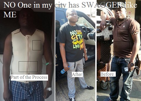 Ivan Semwanga before, during and after the surgery