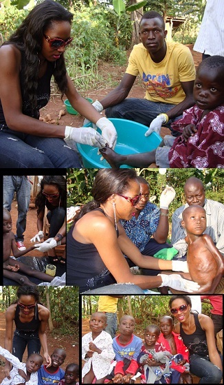 Miss Uganda helping a family with jiggers in Luagzi